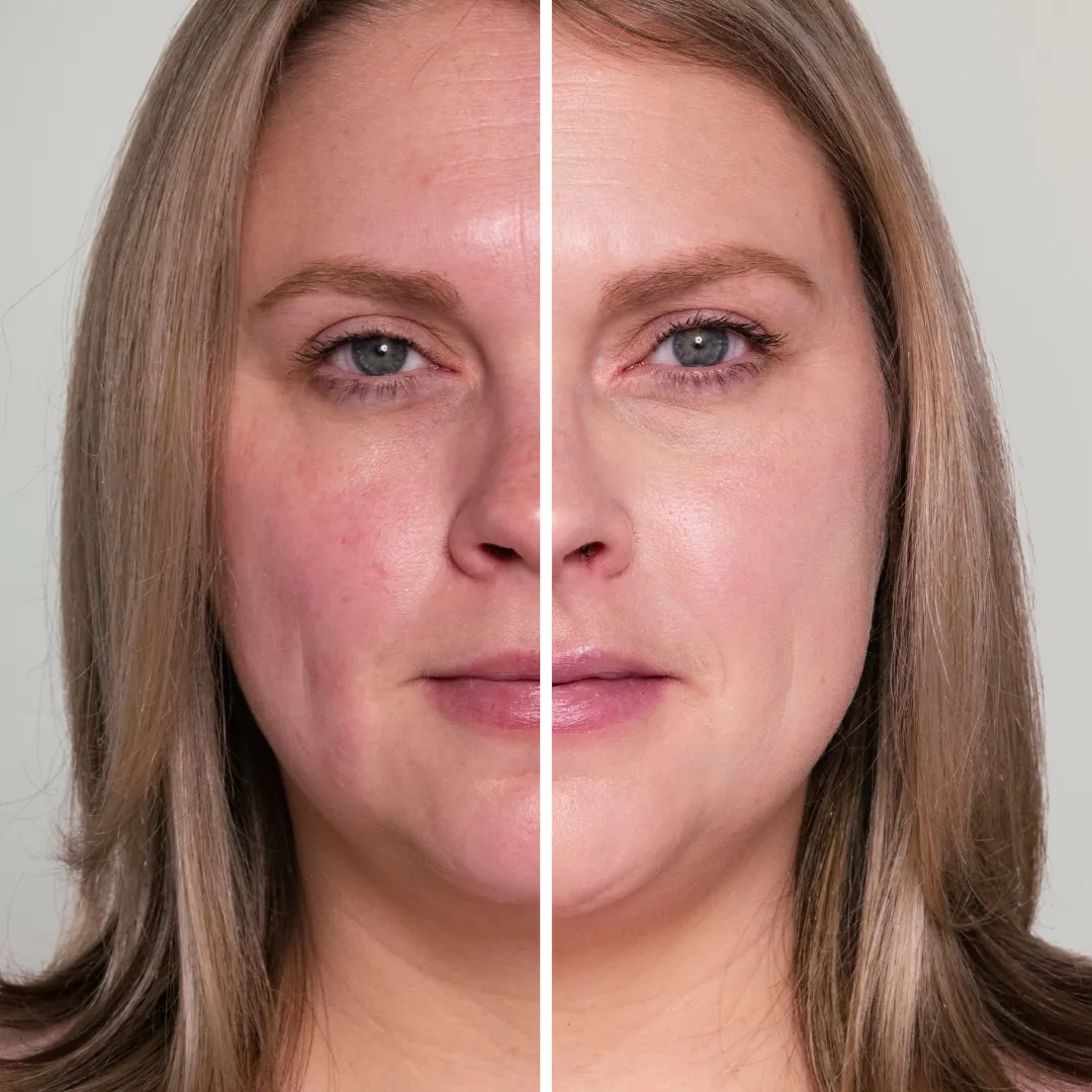 Hydropure™ Color Correcting Serum