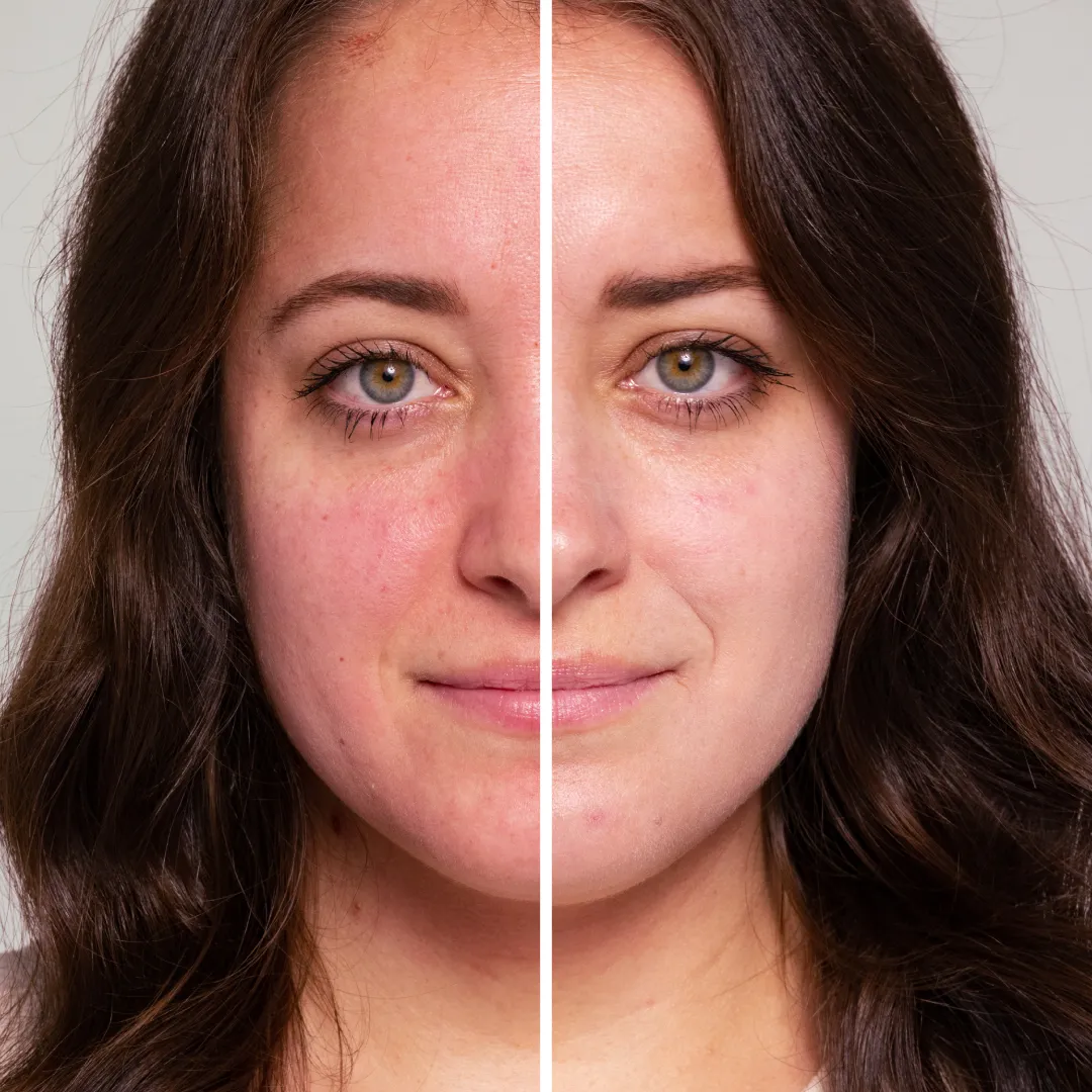 Hydropure™ Color Correcting Serum